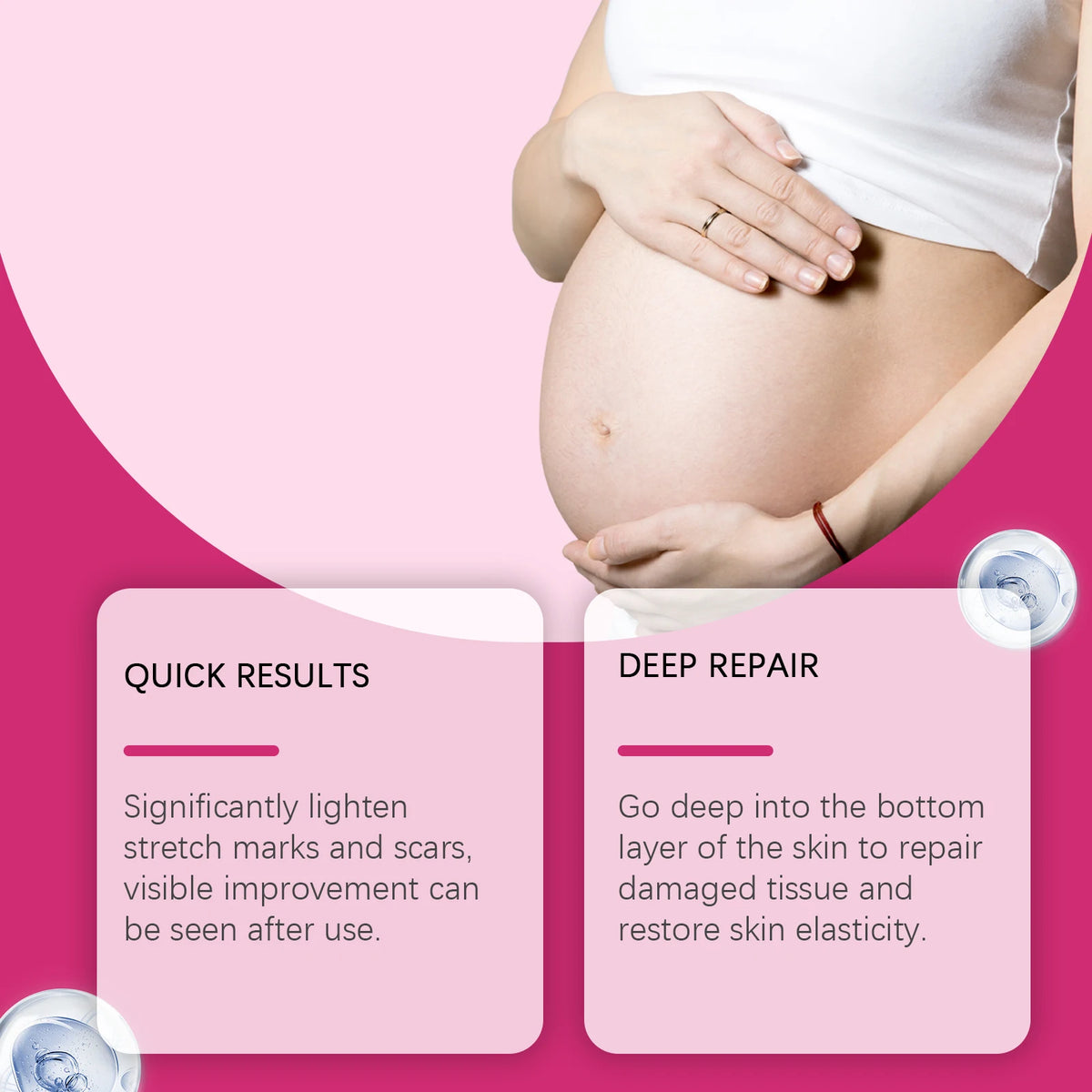 EELHOE Stretch Marks Removal Cream – 150ml