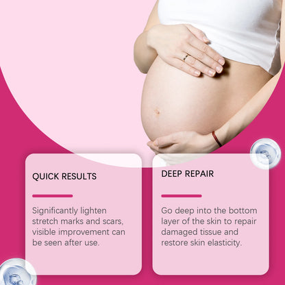 EELHOE Stretch Marks Removal Cream – 150ml