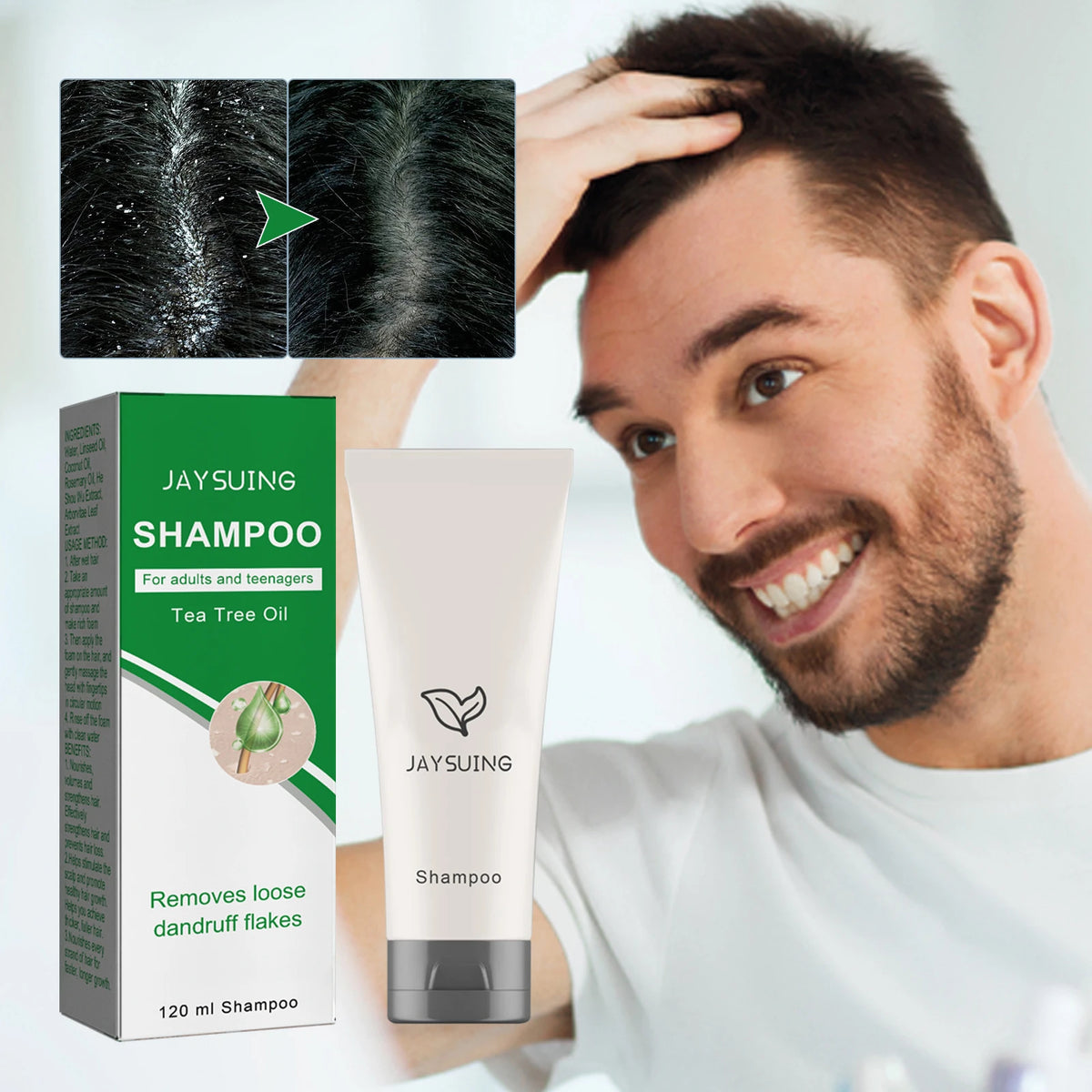 Anti-Dandruff Seborrheic Shampoo – Anti-Itching Scalp Treatment & Oil Control (120ml)